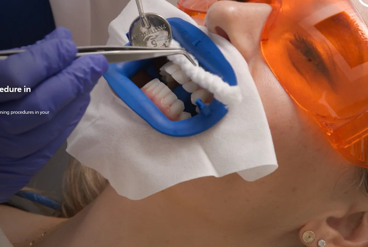 2 Person Complete Procedures Teeth Whitening Kit N568171